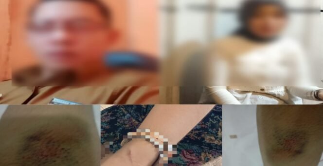 
Atasan Bungkam,Dugaan kekerasan oknum Kabid terhadap pemandu Lagu semakin di sorot