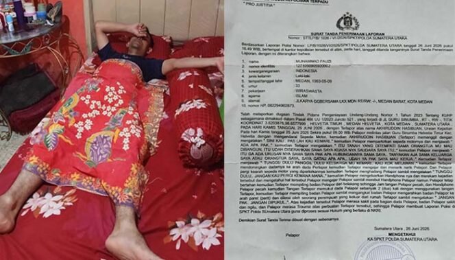 
Mantan AKBP Achirudin Hasibuan Dilaporkan ke Polda Sumut Usai Aniyaya Wartawan